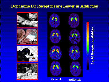 Image of brain activity dopamine